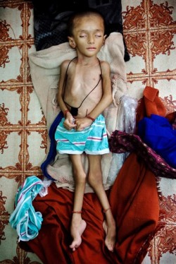 Zubin, a child from a gas and water contamination afected area near the UC factory site