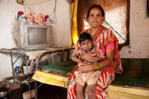 birth defects, Bhopal