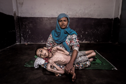 BHOPAL, INDIA: Sameer, 16 years old, held by his mother Wahida at home in the Jamalpura neighborhood. Sameer was born to parents contaminated by a carcinogenic and mutagenic water supply.