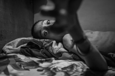 BHOPAL, INDIA: Suraj, 20 years old, at home in the Kainchi Chola neighborhood. Suraj was born to parents contaminated by a carcinogenic and mutagenic water supply. This year marks the 31st anniversary of the 1984 Union Carbide gas tragedy that killed up to 10,000 of the citizens of Bhopal within 72 hours and has gone on to claim in total 25,000 lives to date. The original site of the toxic pesticide plant was never cleaned up and remains, as referred to by Greenpeace as one of the world's 'toxic hotspots'. Thousands of families, for decades, been using water contaminated with toxic chemicals as their primary supply leading to serious illnesses, including cancers, and a spate of birth defects in their children.