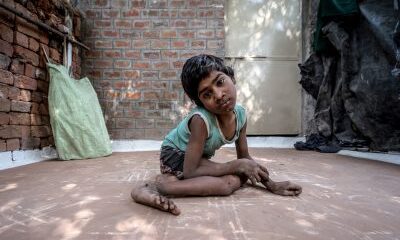 Child in Bhopal harmed by Union Carbide's poisons